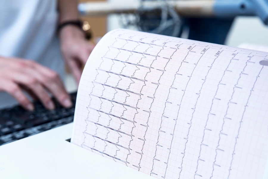 تخطيط القلب بالمجهود في المستشفى السعودي الألماني المدينة المنورة