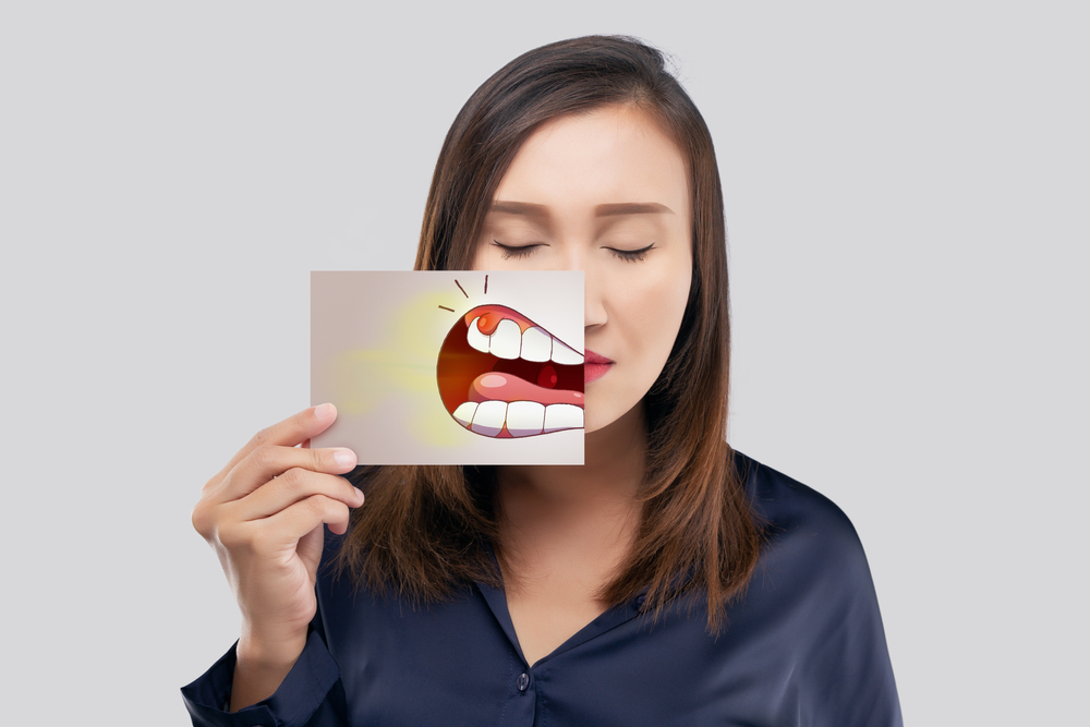 مدة شفاء خراج الأسنان