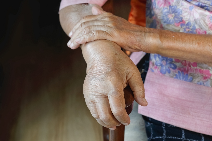 من هو الطبيب المختص في علاج الوذمة اللمفاوية