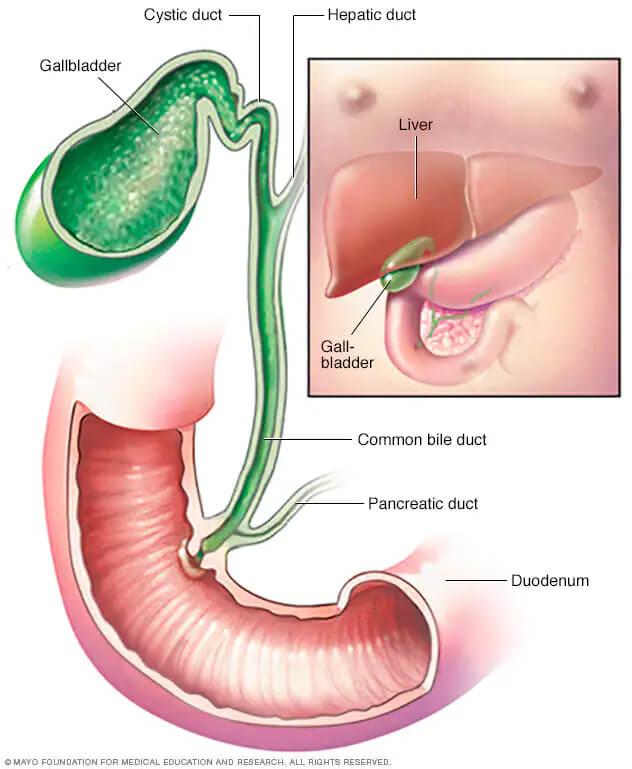 Understanding the Symptoms of Gallbladder Rupture: When to Seek Emergency Care