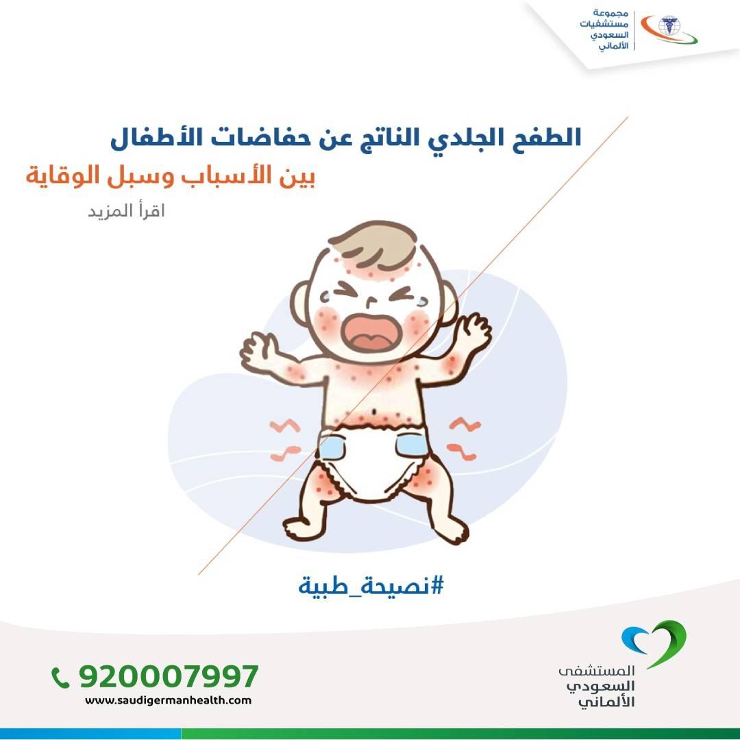 الطفح الجلدي الناتج عن حفاضات الأطفال بين الأسباب & سبل الوقاية