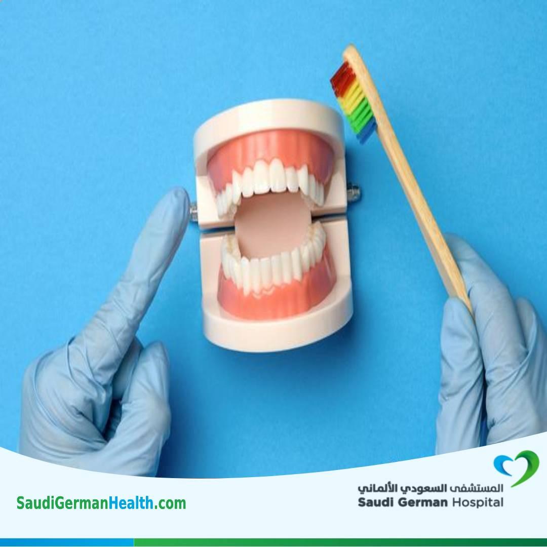 علاج التهاب اللثة بعد زراعة الأسنان