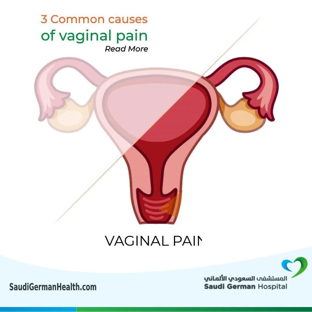 3 common causes of vaginal pain