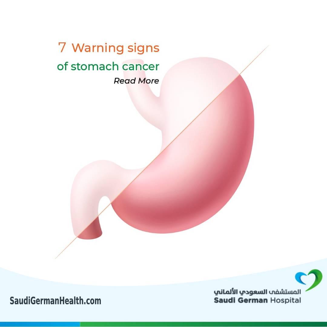 7 Warning signs of stomach cancer