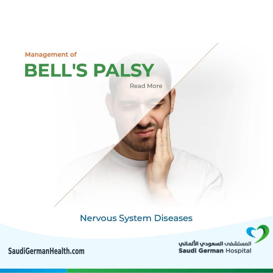Management of Bell's palsy