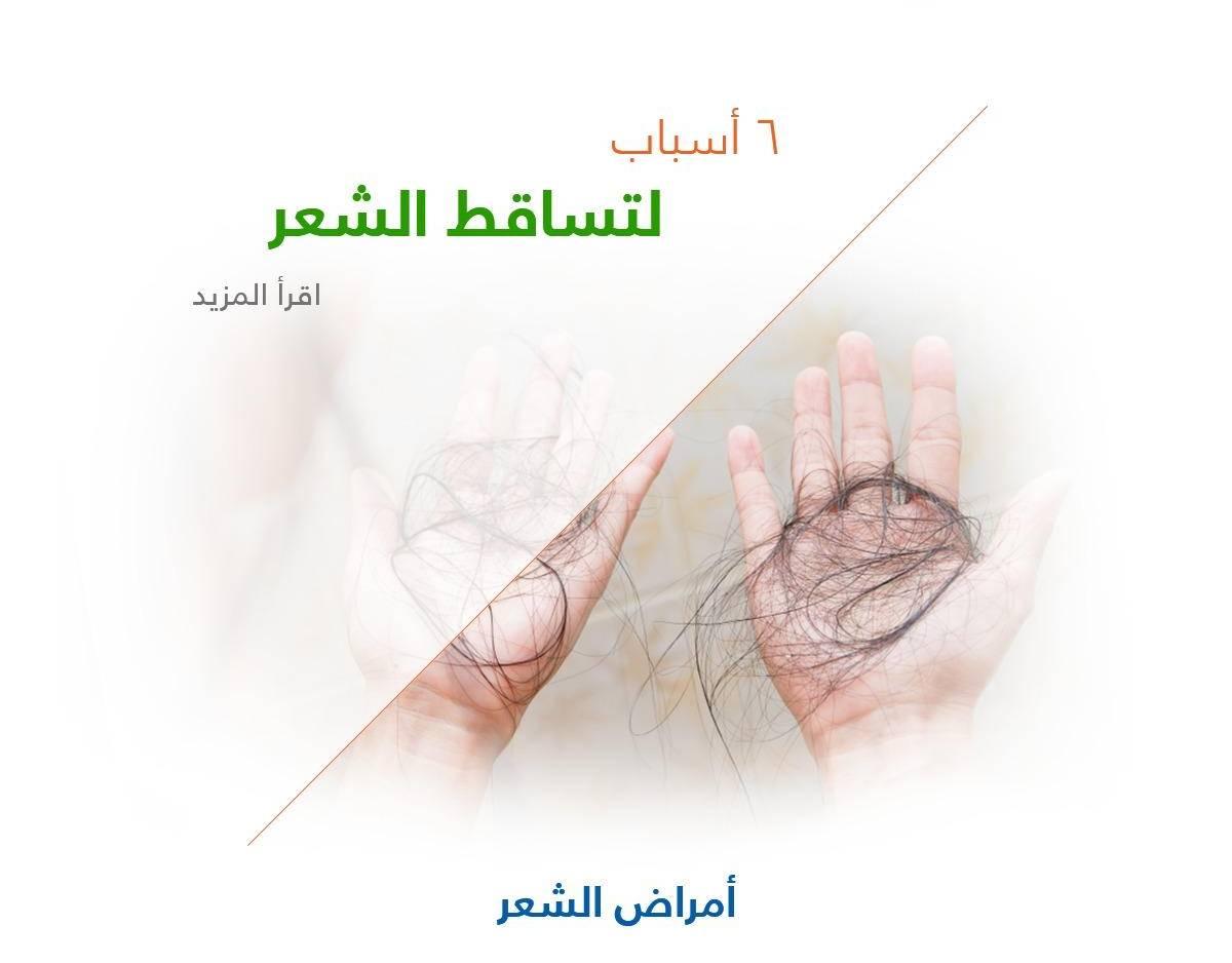 6 أسباب لتساقط الشعر