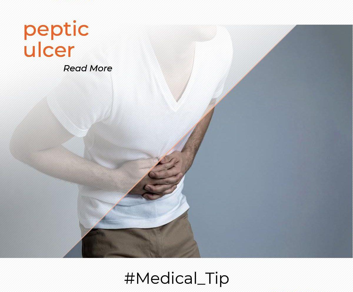 6 Causes for peptic ulcer
