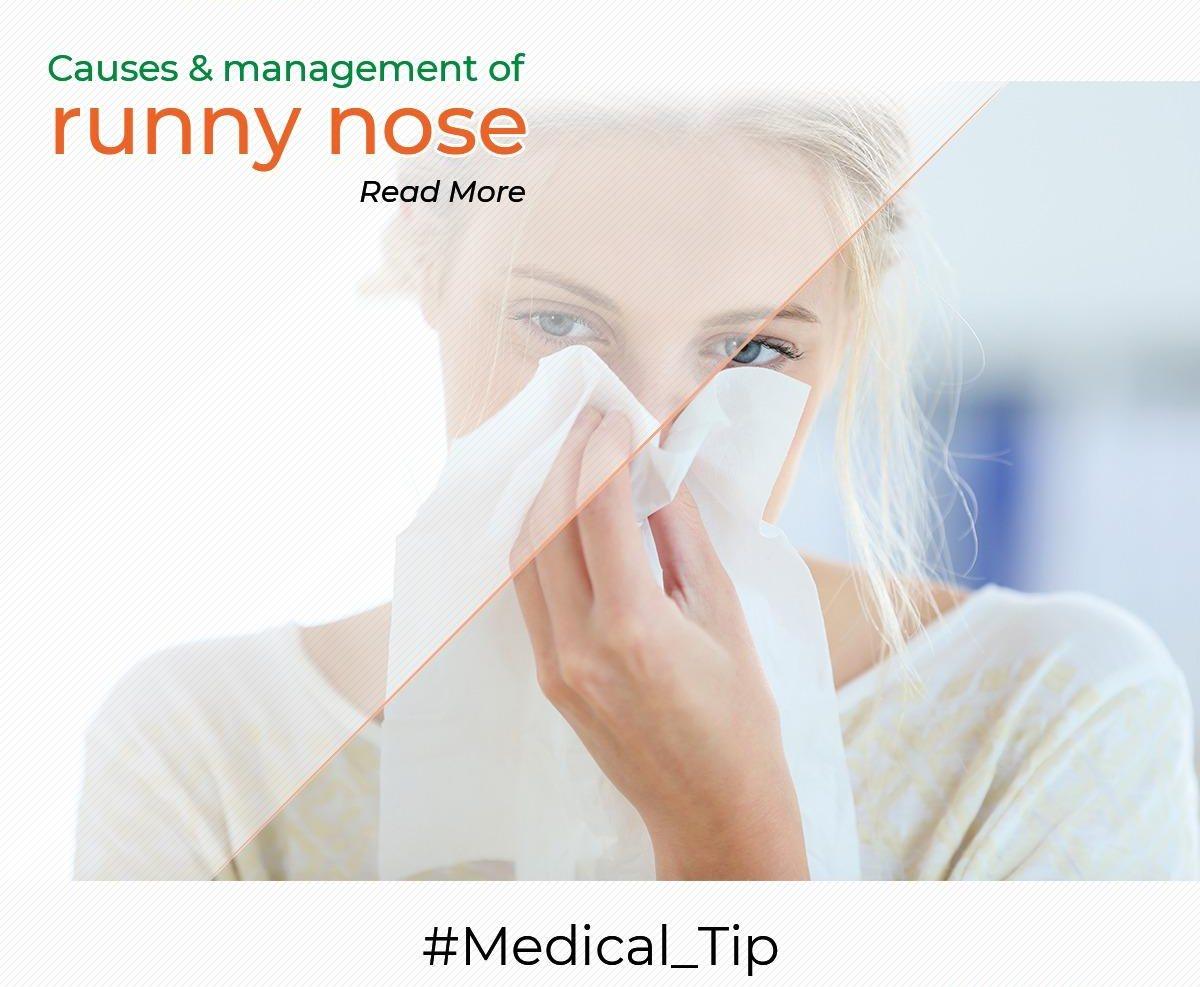 Causes & management of runny nose