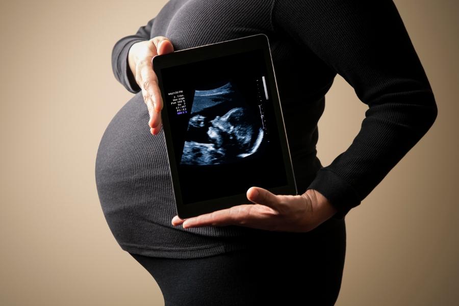 نسبة التحليل الرقمي للحمل الطبيعي