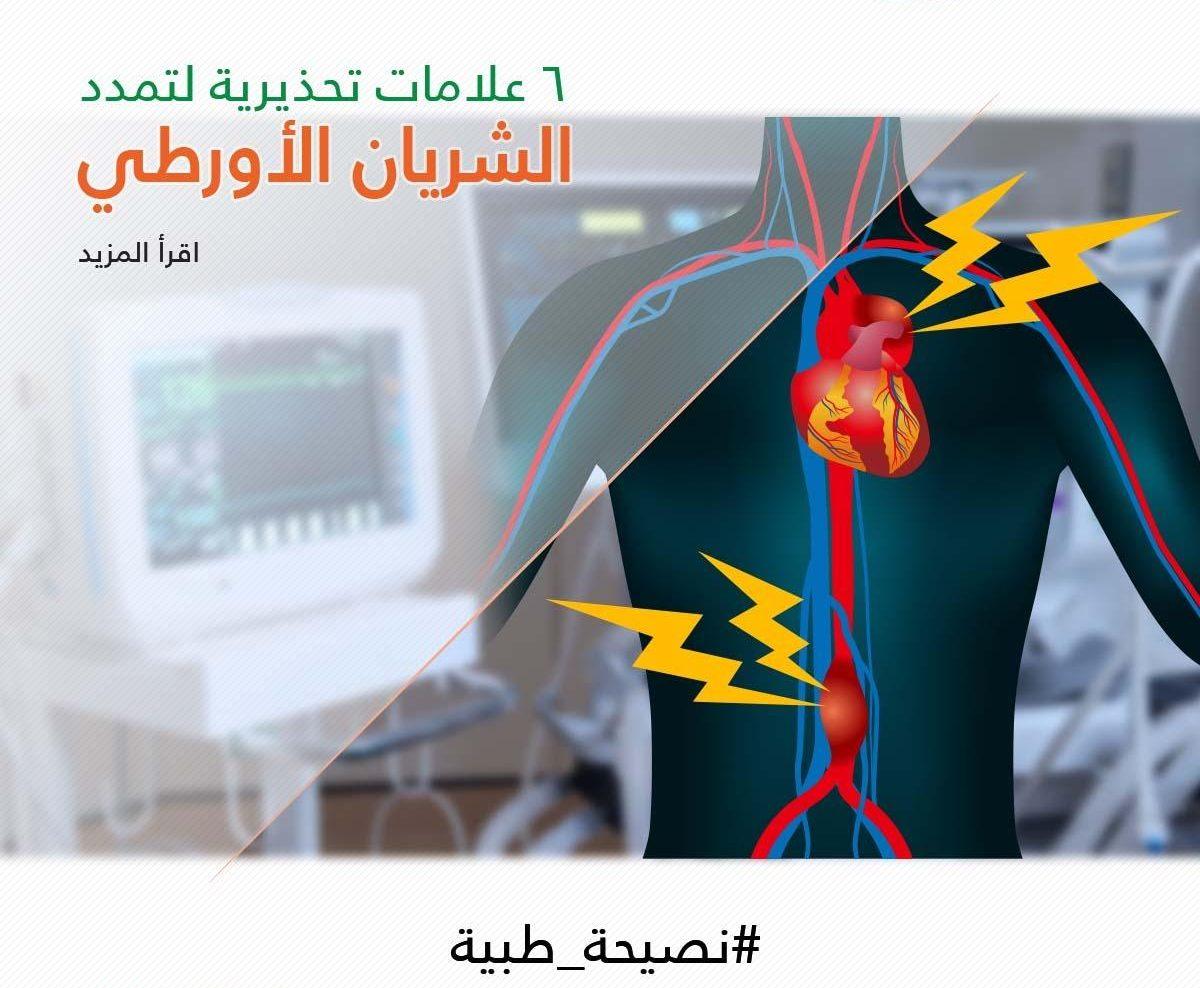 6 علامات تحذيرية لتمدد الشريان الأورطي