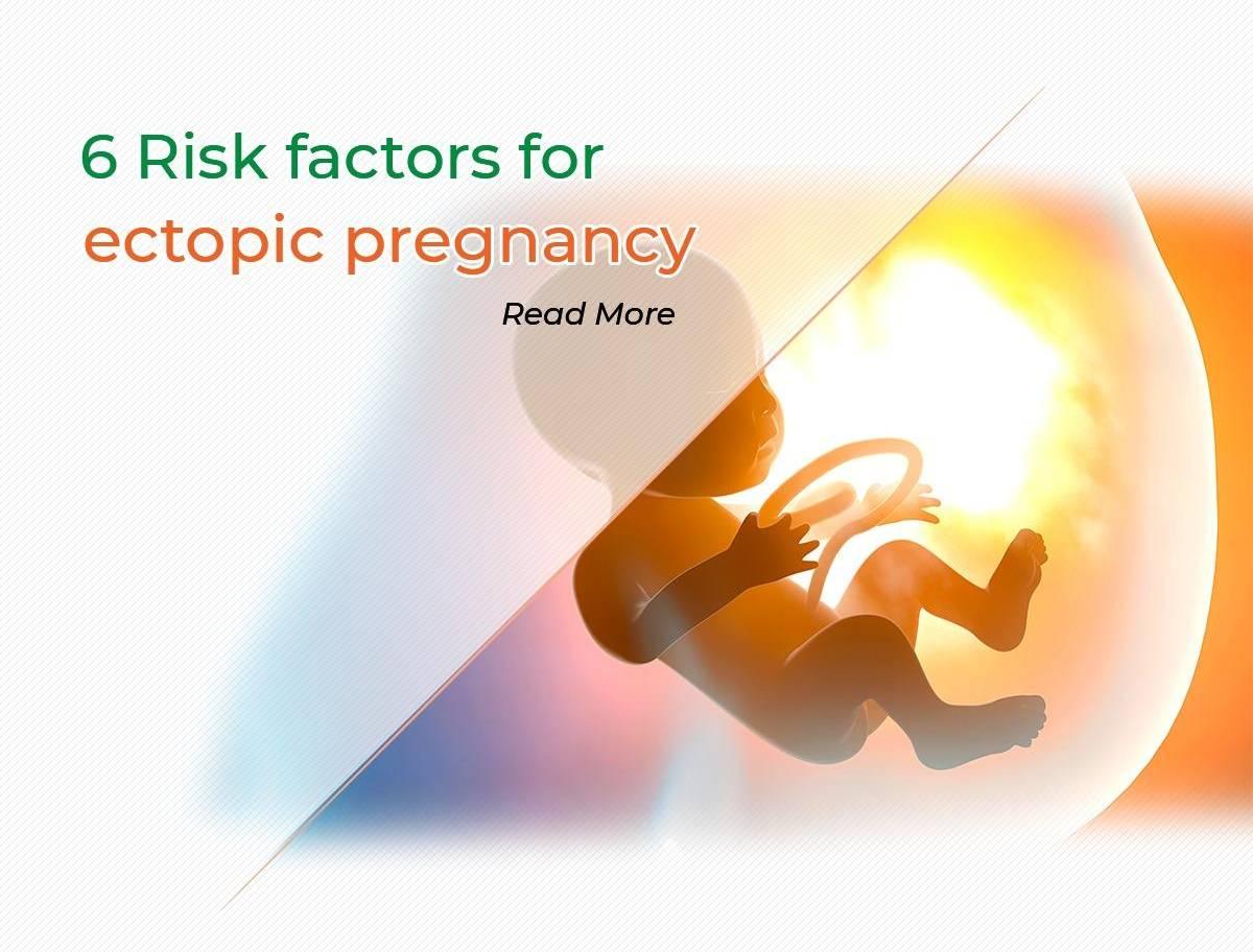 6 Risk factors for ectopic pregnancy