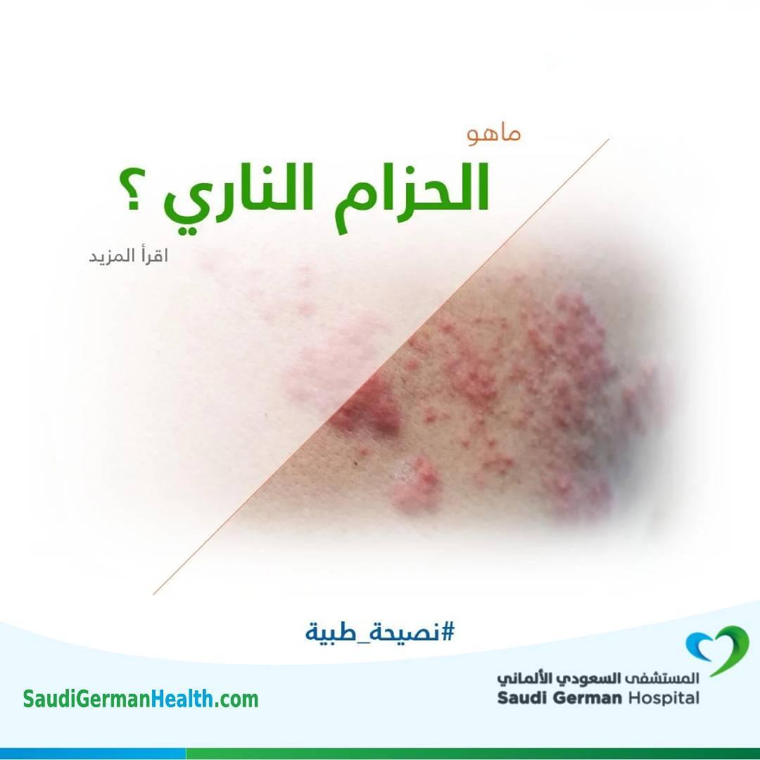 ماهو الحزام الناري ؟