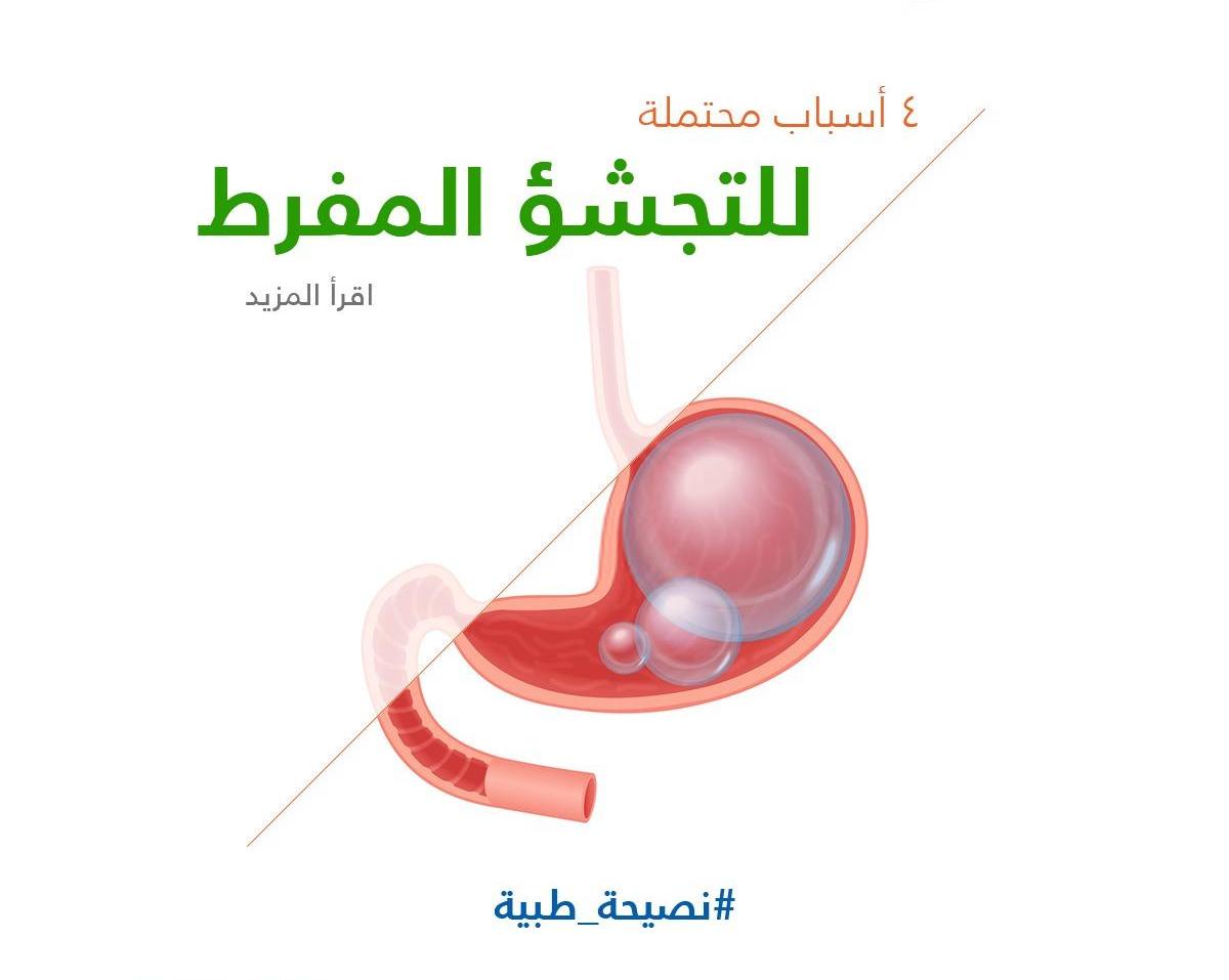 4 أسباب محتملة للتجشؤ المفرط