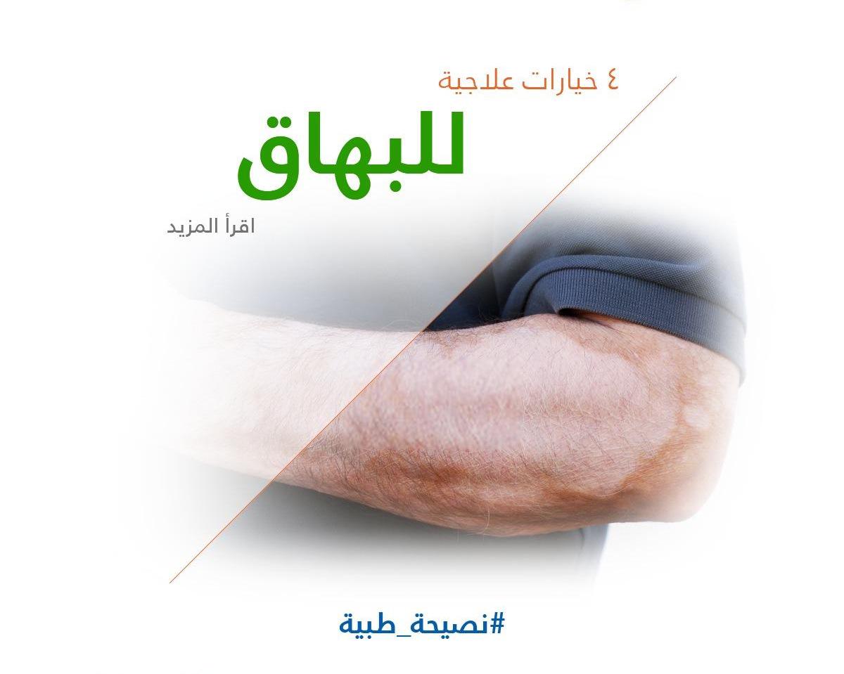 4 خيارات علاجية للبهاق