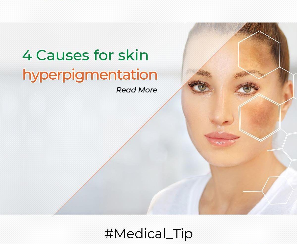 4 Causes for skin hyperpigmentation