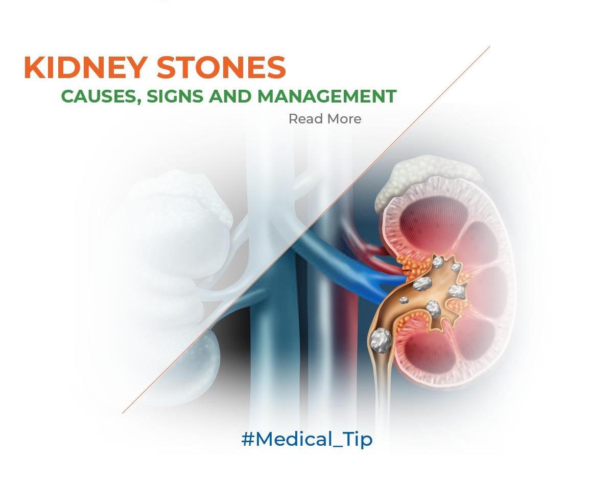 Kidney stones; causes, signs and management