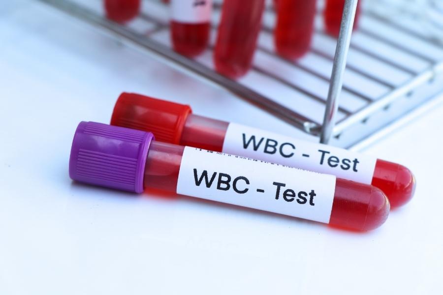 تحليل WBC
