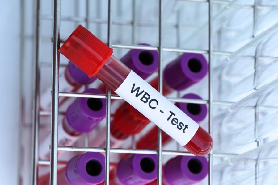 تحليل wbc النسبة الطبيعية