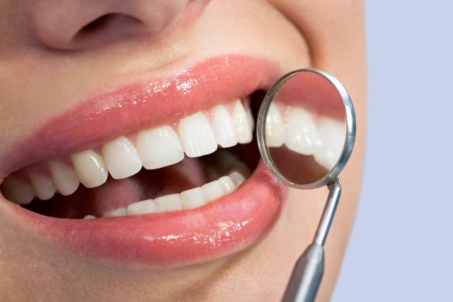 ابتسامة هوليود اسنان الارنب