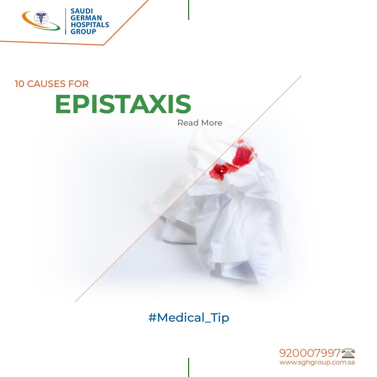 10 Causes for epistaxis
